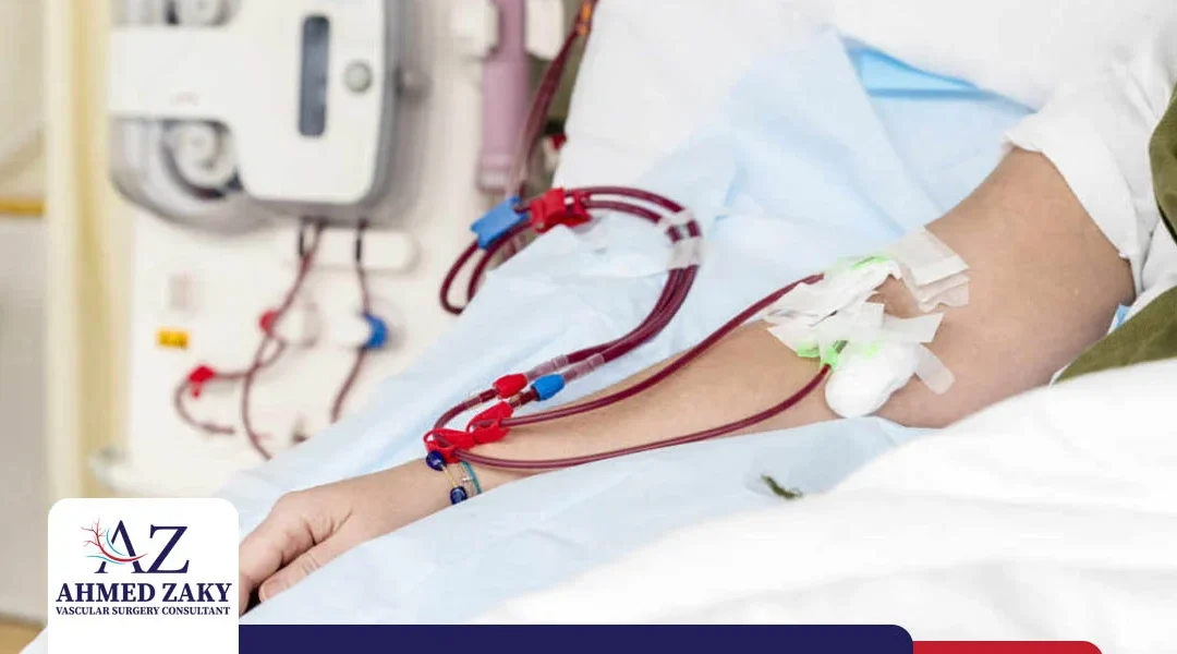 الوصلة الوريدية الشريانية لمرضى غسيل الكلى | نصائح و تعليمات هامة