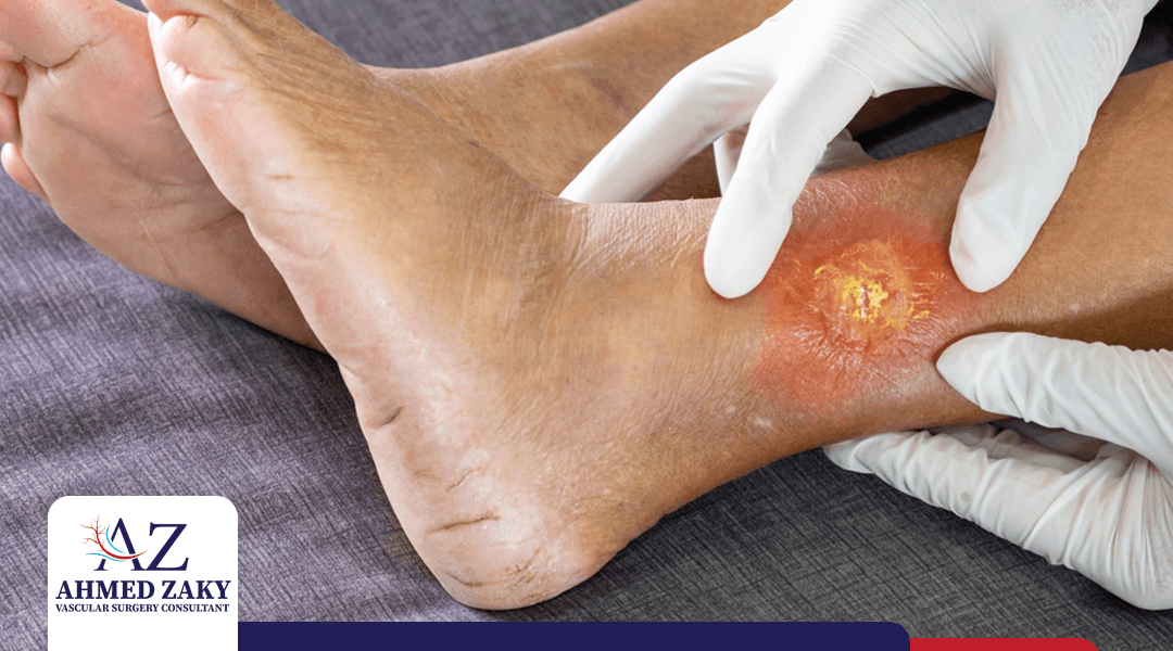 متي يجب زيارة دكتور قدم سكري وكيفية اختياره؟