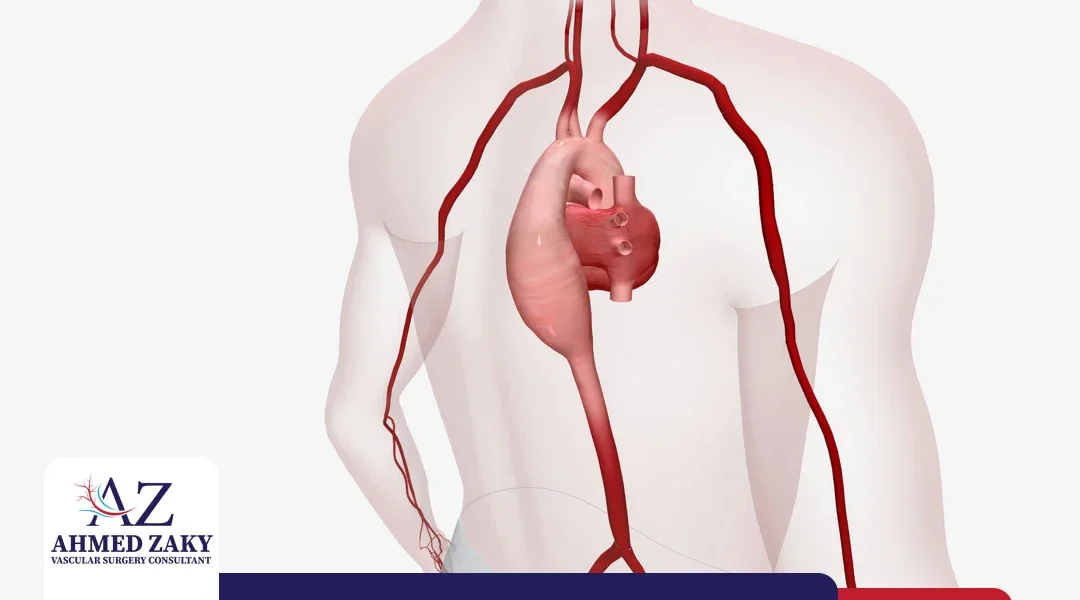 هل أعراض تمدد الشريان الأورطي كافية لتشخيص المرض؟