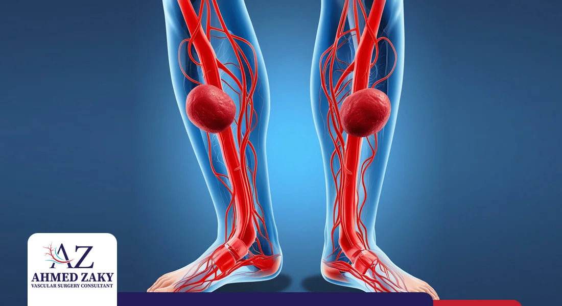 انواع جلطات الساق أنواع جلطات الساق