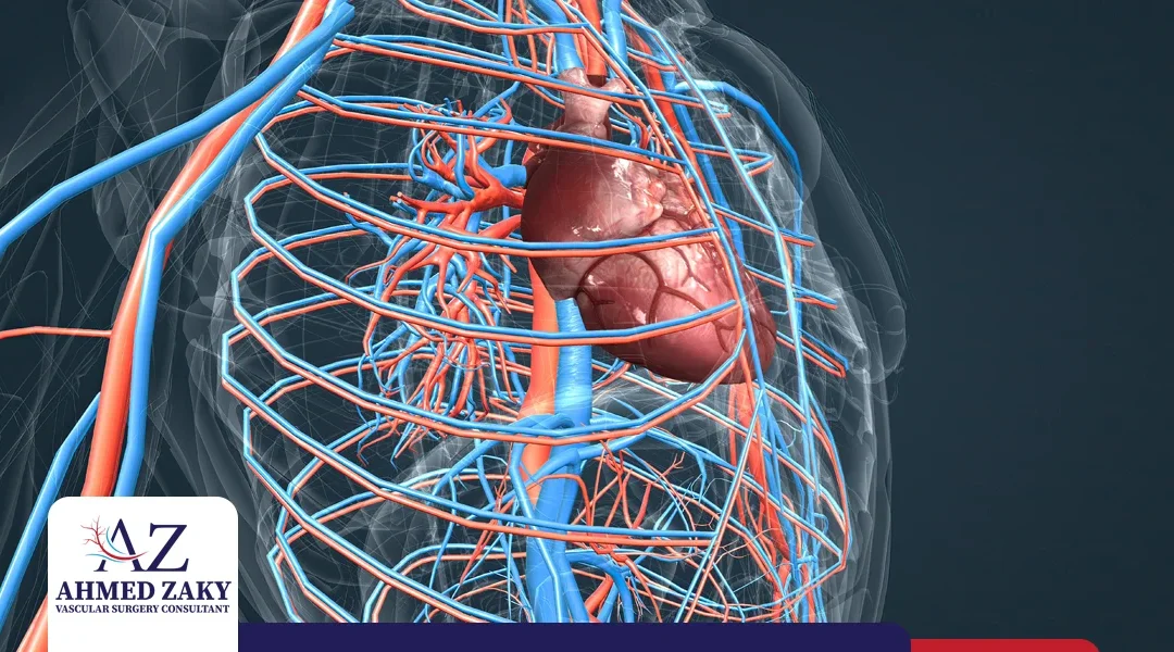 أساليب علاج ضيق الشريان الأورطي ومضاعفات إهمال العلاج