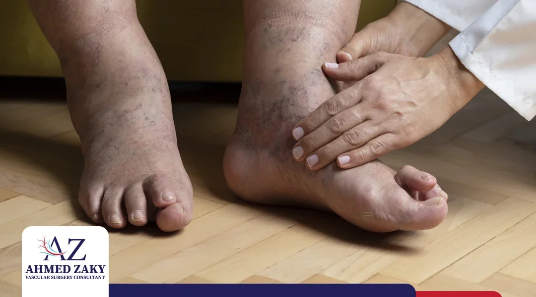طريقة فحص القدم السكرية