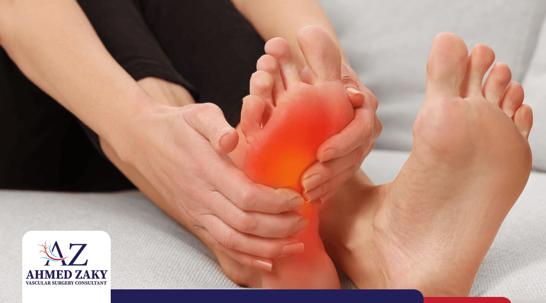 احمرار القدمين عند مريض السكر.. هل هو مشكلة خطيرة؟
