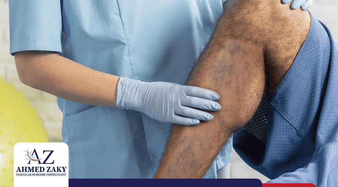 علاج دوالي الساقين بالجراحة