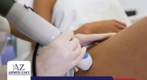 علاج دوالي الساقين