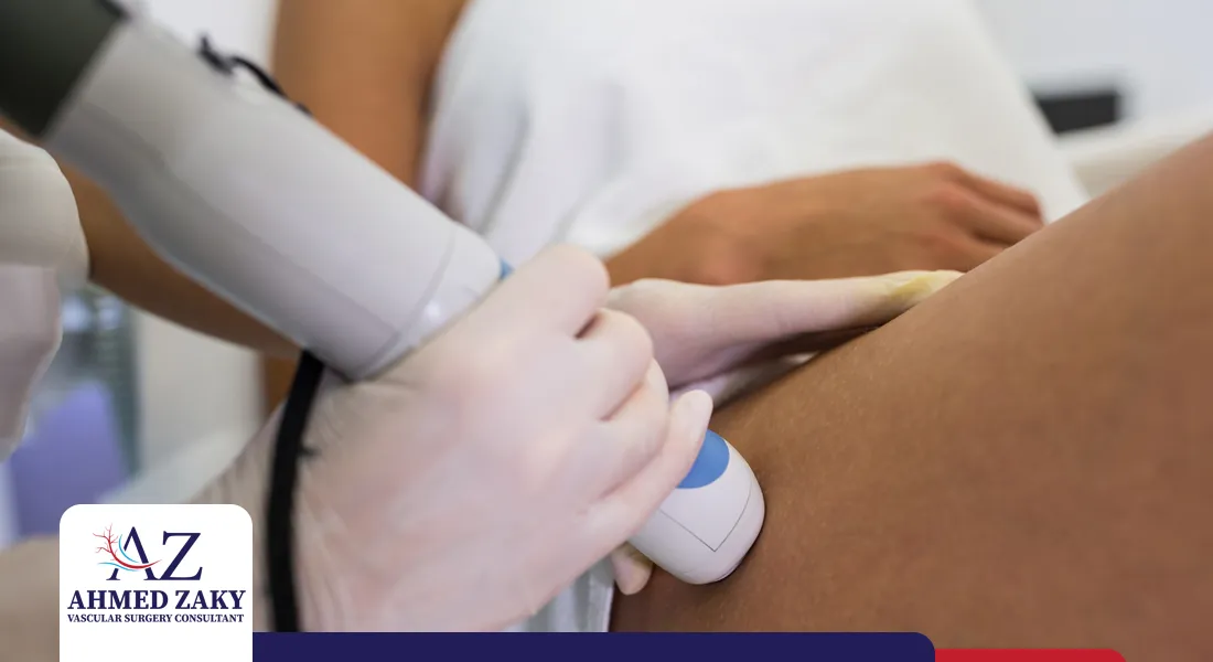 علاج-دوالي-الساقين علاج دوالي الساقين