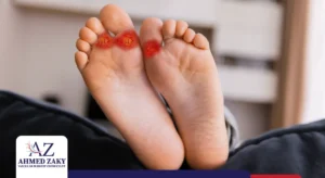 أعراض الغرغرينا في بدايتها