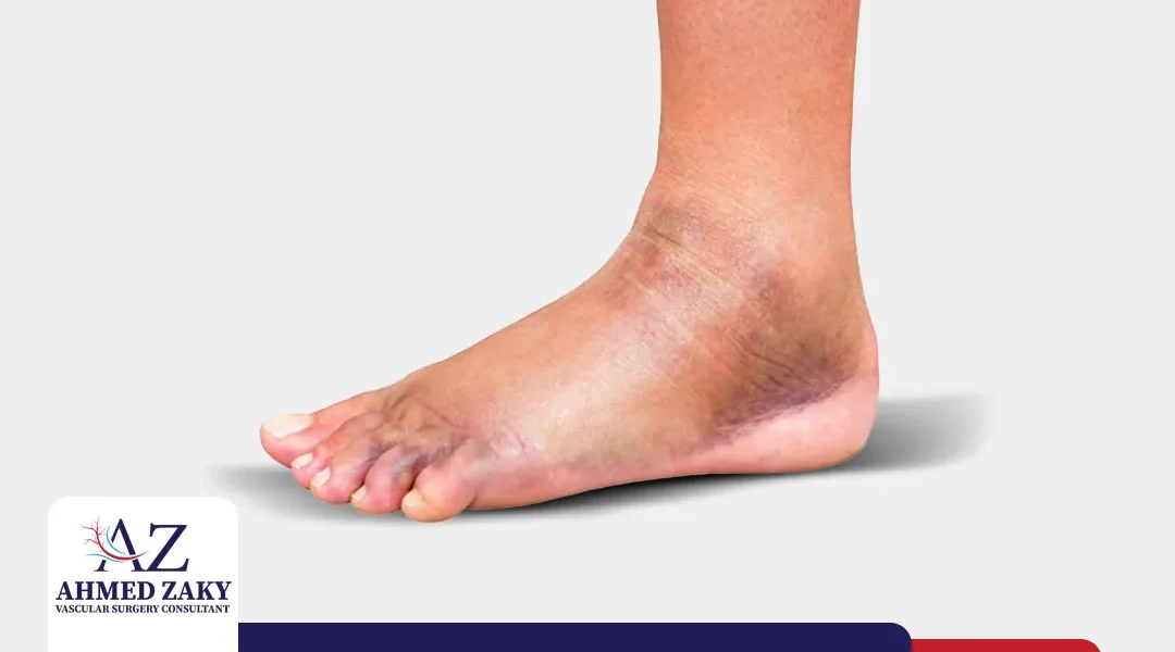 علاج انتفاخ القدمين عند كبار السن يبدأ من فهم السبب الحقيقي