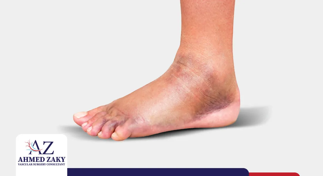 علاج-انتفاخ-القدمين-عند-كبار-السن علاج انتفاخ القدمين عند كبار السن