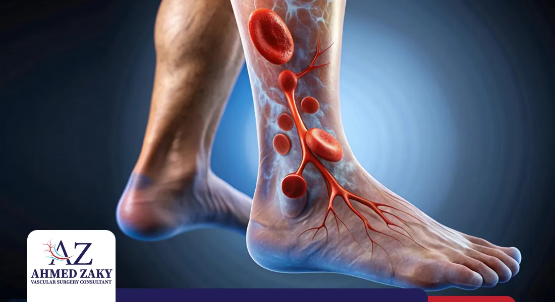 أسباب-انسداد-الشرايين-الطرفية أسباب انسداد الشرايين الطرفية