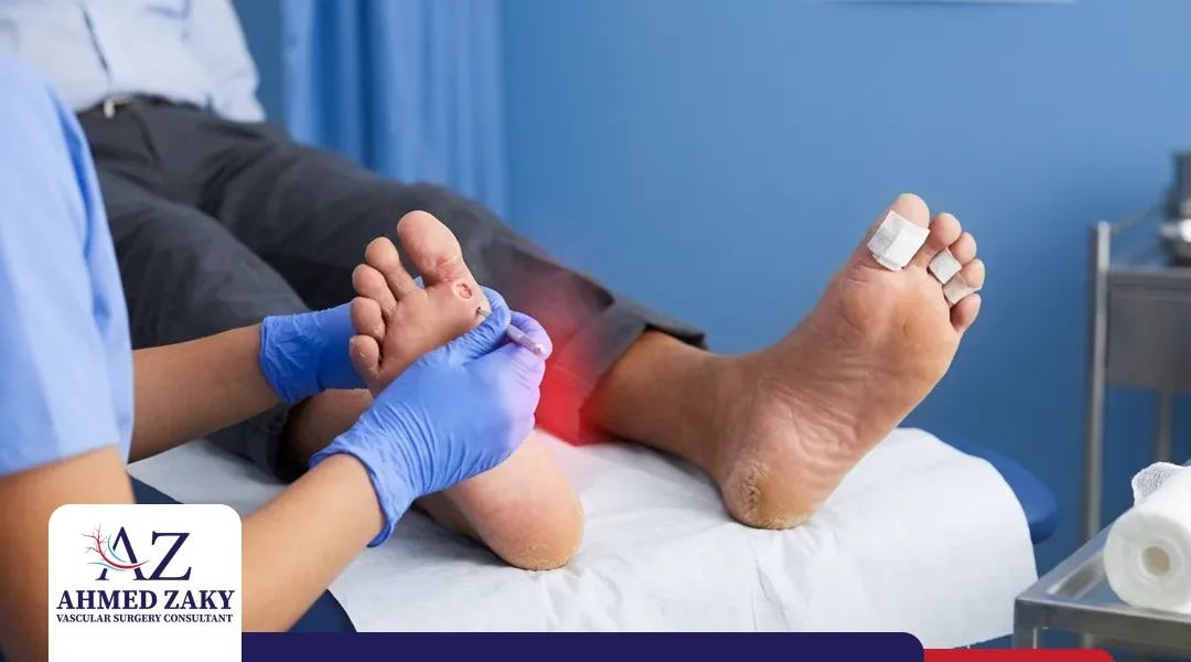 كيف تتجنب أخطر مضاعفات أنواع جروح السكري؟